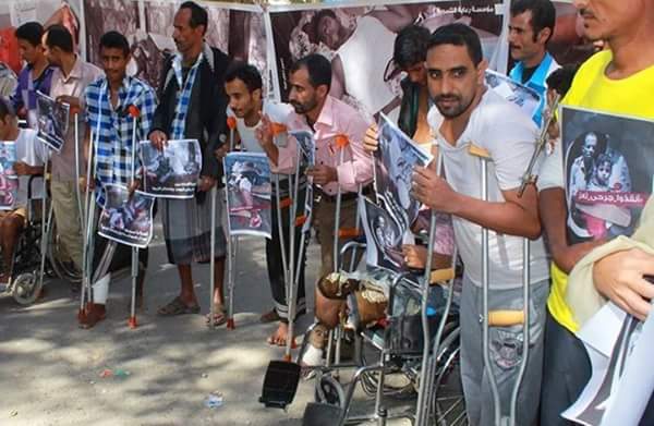 150Taiz Popular Resistance wounded to fly to Turkey for treatment 150Taiz Popular Resistance wounded to fly to Turkey for treatment