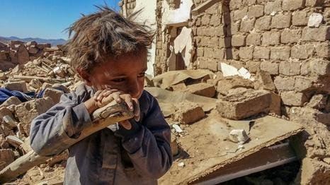 الأمم المتحدة: الحرب أعادت اليمن عشرين عاماً للوراء وخلفت ربع مليون قتيل الأمم المتحدة: الحرب أعادت اليمن عشرين عاماً للوراء وخلفت ربع مليون قتيل
